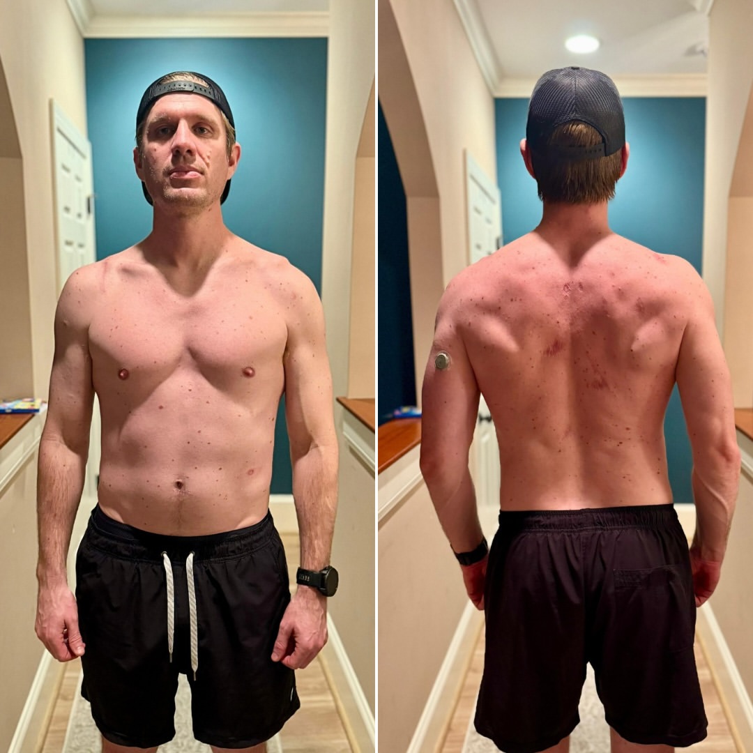 Andrew 25 weeks of controlled gaining before